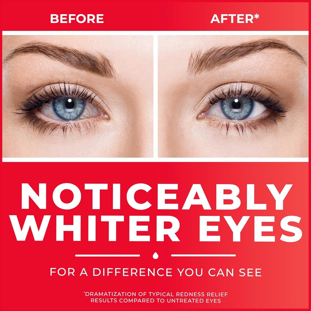 clear-eyes-redness-relief-eye-drops-whit-3.jpg